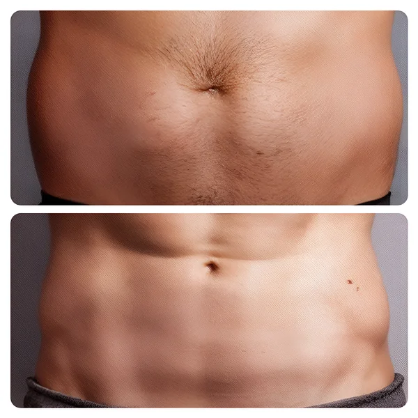 Rueda Abdominal para Entrenamiento - Imagen 6